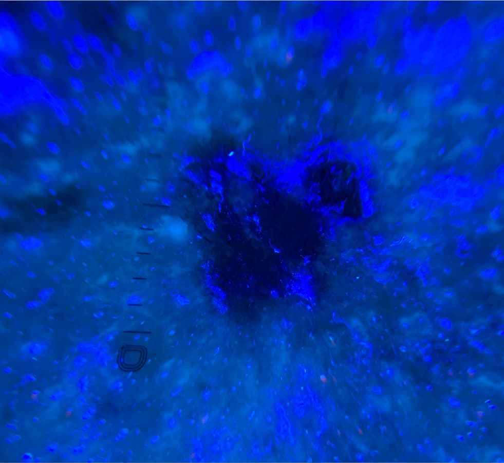 Mapeamento corporal digital